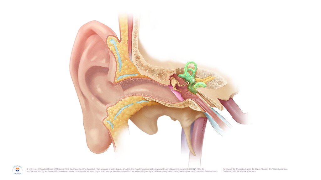 Vem får tinnitus?